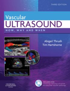 Vascular Ultrasound