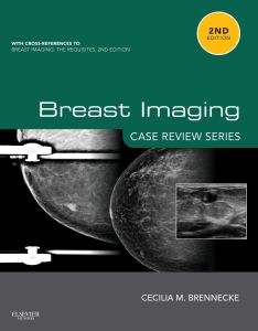 Breast Imaging: Case Review Series