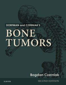 Dorfman and Czerniak’s Bone Tumors E-Book