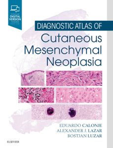 Diagnostic Atlas of Cutaneous Mesenchymal Neoplasia E-Book