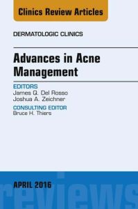 Advances in Acne Management, An Issue of Dermatologic Clinics