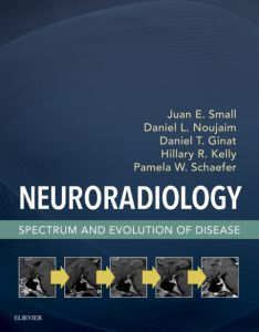 Neuroradiology