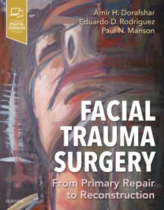 Facial Trauma Surgery E-Book