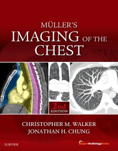 Muller's Imaging of the Chest E-Book