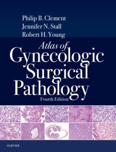 Atlas of Gynecologic Surgical Pathology E-Book