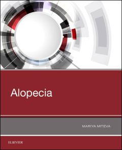 Alopecia