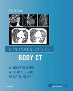 Fundamentals of Body CT E-Book