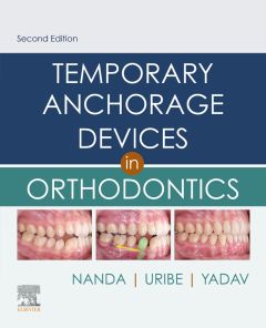 Temporary Anchorage Devices in Orthodontics E-Book