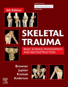 Skeletal Trauma E-Book