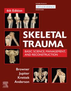 Skeletal Trauma E-Book