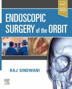 Endoscopic Surgery of the Orbit E-Book