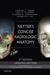 Netter's Concise Radiologic Anatomy Updated Edition E-Book