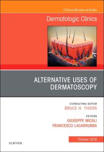 Alternative Uses of Dermatoscopy, An Issue of Dermatologic Clinics