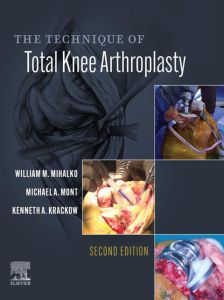 The Technique of Total Knee Arthroplasty E-Book