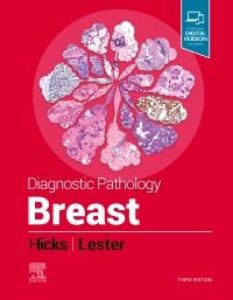 Diagnostic Pathology: Breast, E-Book