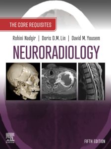 Neuroradiology: The Requisites E-Book