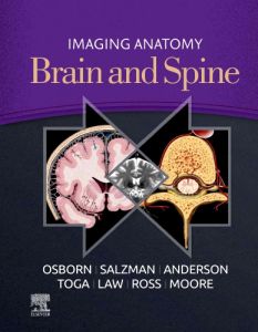 Imaging Anatomy Brain and Spine, E-Book