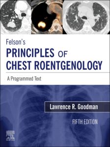 Felson's Principles of Chest Roentgenology E-Book