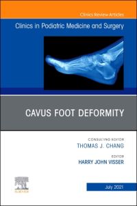 Cavus Foot Deformity, An Issue of Clinics in Podiatric Medicine and Surgery, E-Book