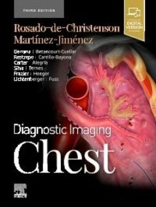 Diagnostic Imaging: Chest - E-Book