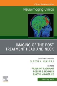 Imaging of the Post Treatment Head and Neck, An Issue of Neuroimaging Clinics of North America, E-Book