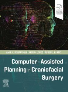 Computer-Assisted Planning in Craniofacial Surgery - E-Book