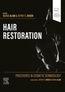 Procedures in Cosmetic Dermatology: Hair Restoration - E-Book