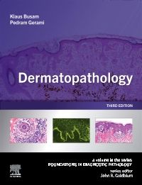 Dermatopathology E-Book