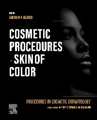 Procedures in Cosmetic Dermatology: Cosmetic Procedures in Skin of Color - E-Book