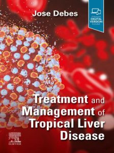 Treatment and Management of Tropical Liver Disease - E-Book