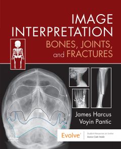 Image Interpretation: Bones, Joints, and Fractures - E-Book