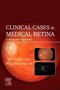 Clinical Cases in Medical Retina - E-Book