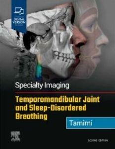 Specialty Imaging: Temporomandibular Joint and Sleep-Disordered Breathing E-Book