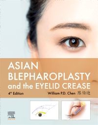 Asian Blepharoplasty and the Eyelid Crease - E-Book