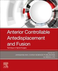 Anterior Controllable Antedisplacement and Fusion (ACAF)