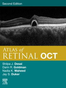 Atlas of Retinal OCT E-Book