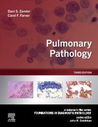 Pulmonary Pathology E-Book