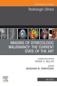 Imaging of Gynecologic Malignancy: The Current State of the Art, An Issue of Radiologic Clinics of North America, E-Book