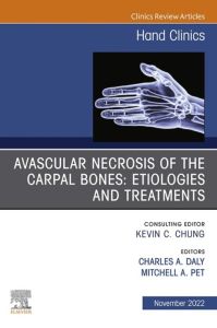 Avascular Necrosis of the Carpal Bones: Etiologies and Treatments, An Issue of Hand Clinics, E-Book