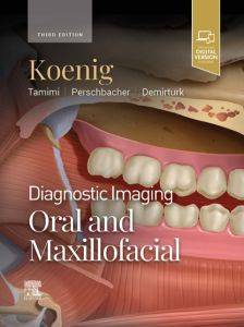 Diagnostic Imaging: Oral and Maxillofacial E-Book