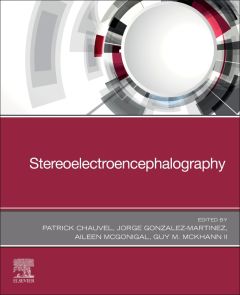 The Fundamentals of Stereoelectroencephalography