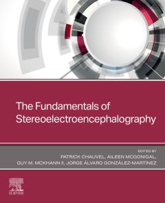 The Fundamentals of Stereoelectroencephalography