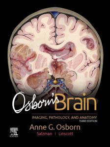 Osborn's Brain E-Book