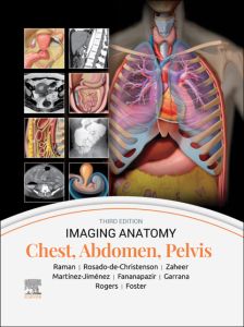 Imaging Anatomy: Chest, Abdomen, Pelvis - E-BOOK