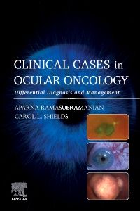 Clinical Cases in Ocular Oncology - E-BOOK