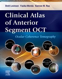 Clinical Atlas of Anterior Segment OCT: Ocular Coherence Tomography - E-Book