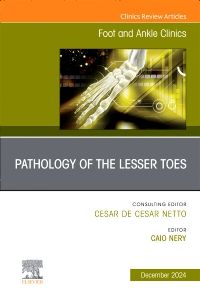 Pathology of the Lesser Toes, An issue of Foot and Ankle Clinics of North America, E-Book