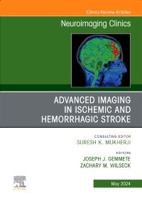 Advanced Imaging in Ischemic and Hemorrhagic Stroke, An Issue of Neuroimaging Clinics of North America, E-Book