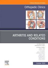 Arthritis and Related Conditions, An Issue of Orthopedic Clinics, E-Book