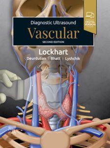 Diagnostic Ultrasound: Vascular - E-book